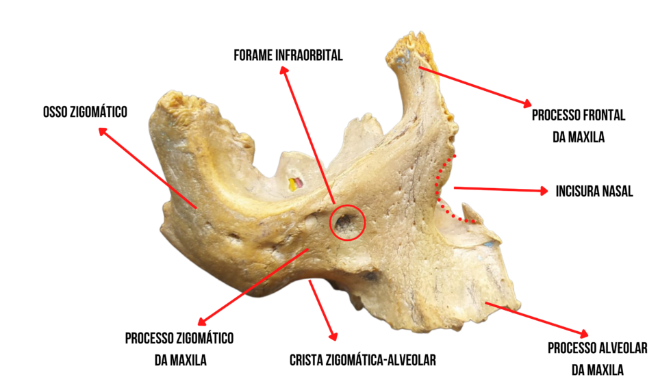 Osso Maxilar Anatomia Odonto