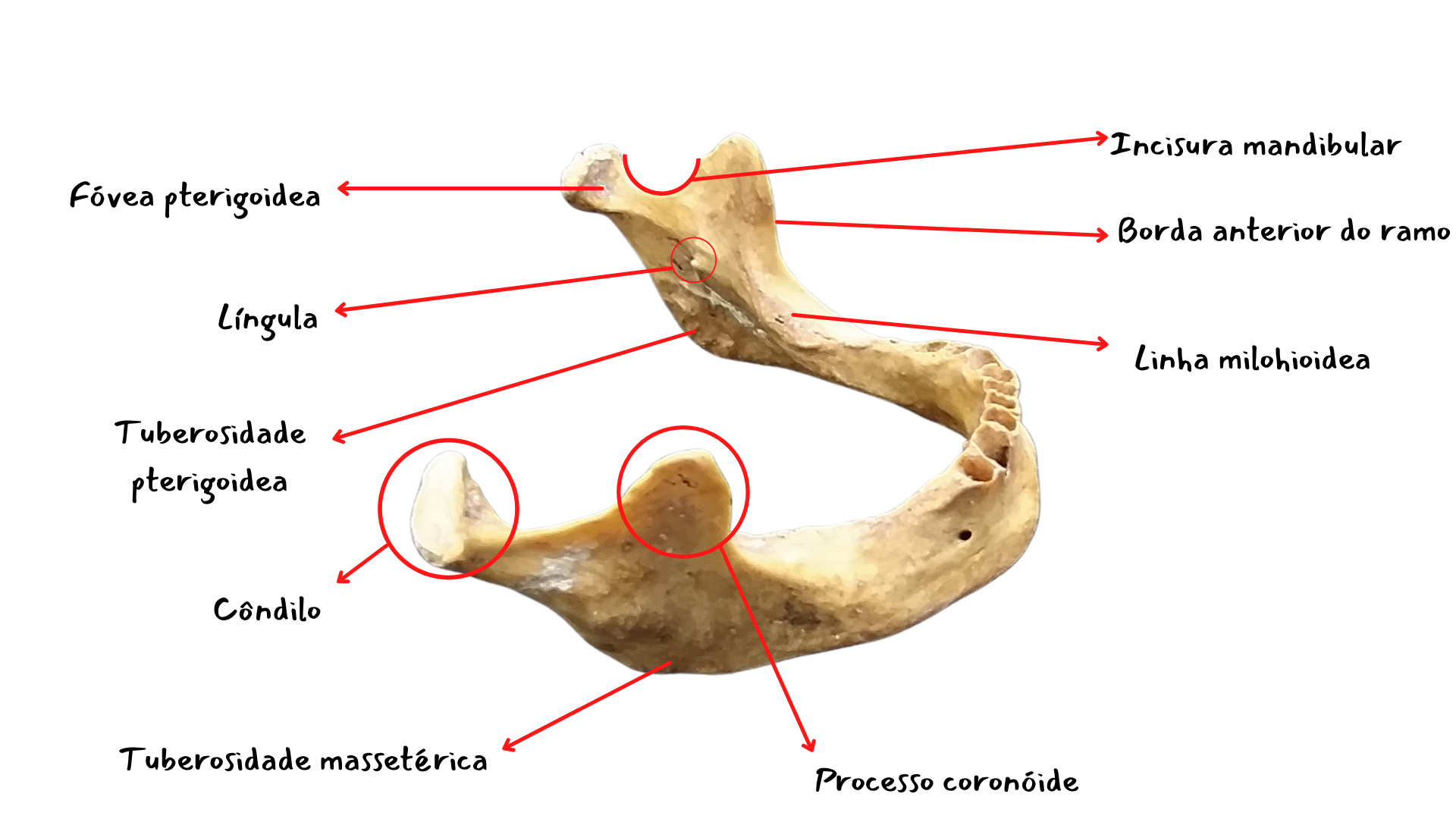 Dra. Dentinhos - 💀 Anatomia da Mandíbula ☠️ ⠀ O que achariam de uma  apostila de anatomia só com desenhos meus? ♥️ ⠀ #anatomia #anato #mandibula  #mandibular #fisiologia #odontologia #medicina #odontoporamor  #studygramodontologia #anatomy #jaw
